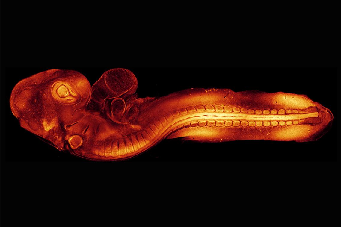 A microscope image of a quail embryo, shown in bright orange against a black background.