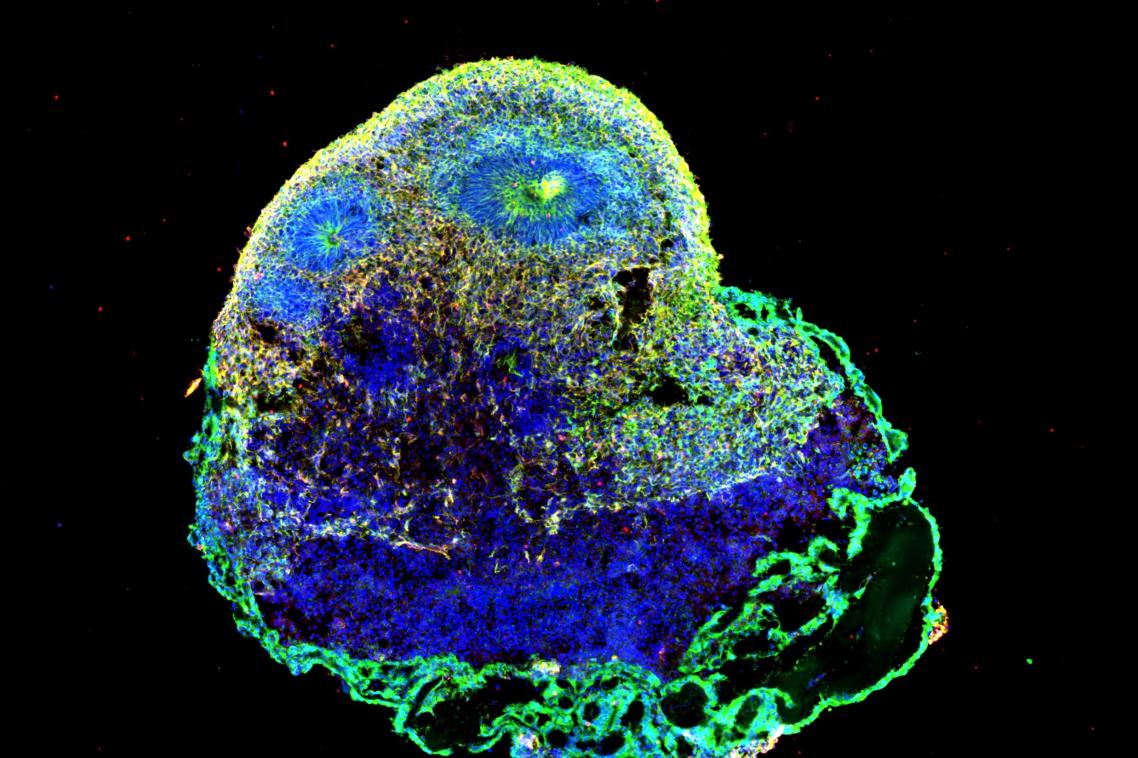 A brain organoid as seen under a microscope.