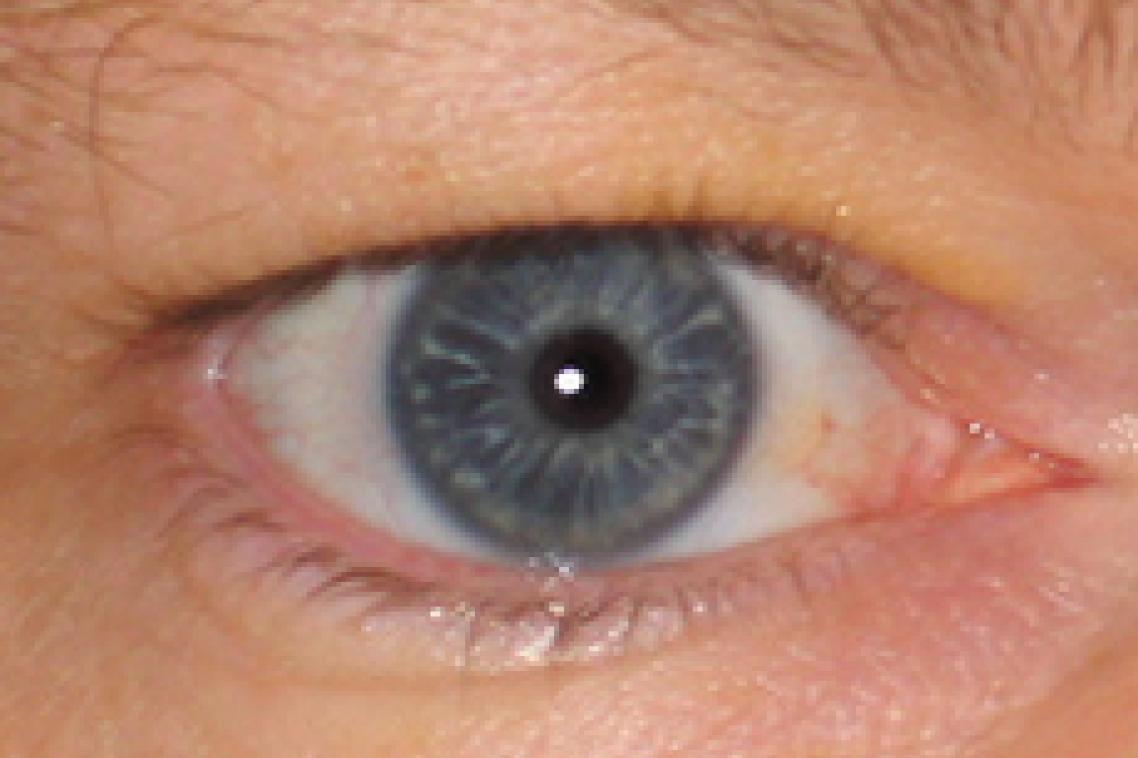 A close up of a person with a blue eye.