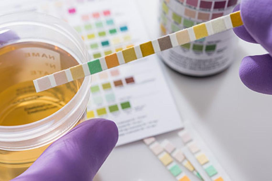A container featuring urine sample being tested by hands in gloves holding testing kit