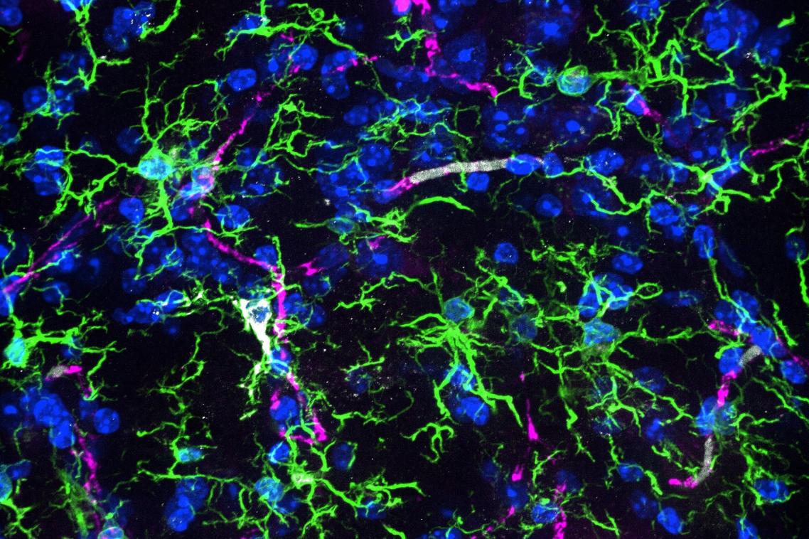 Microglia green cells in an aging mouse brain