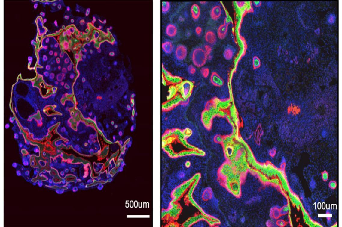 A composite image of two microscopic views of human skin.