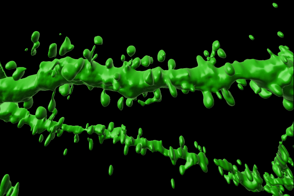 Dendritic spines under magnification. Image, UQ.