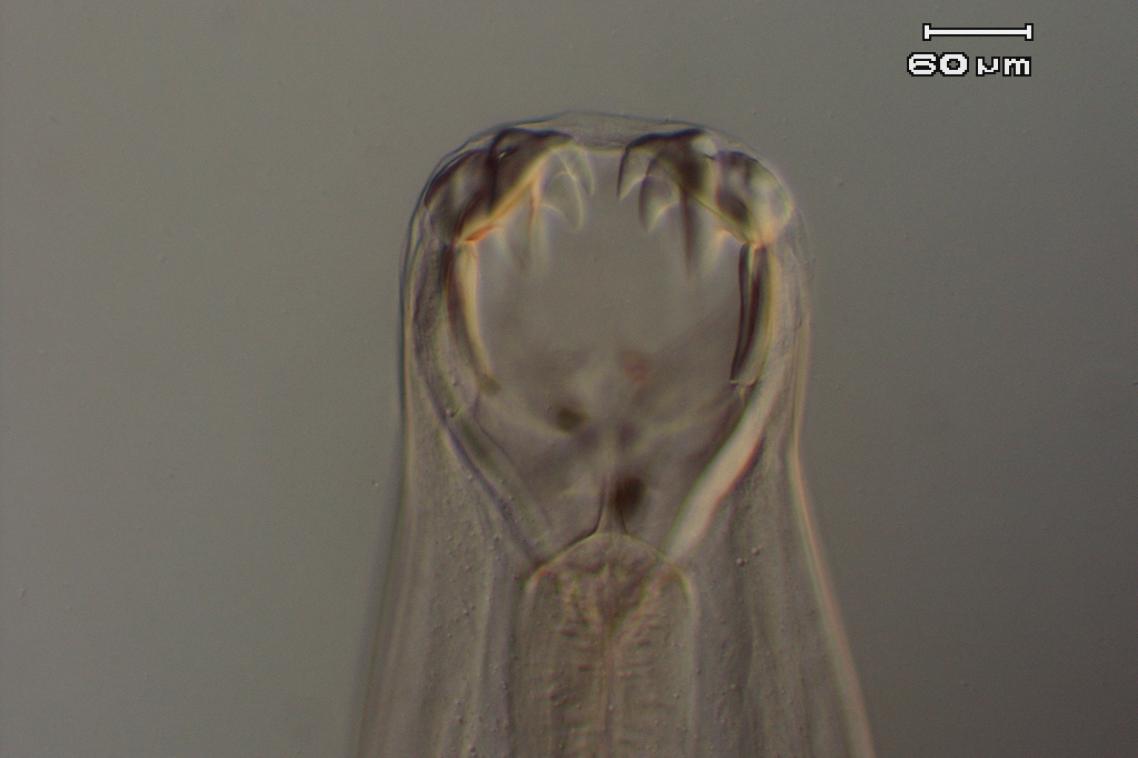 A hookworm viewed under the microscope.