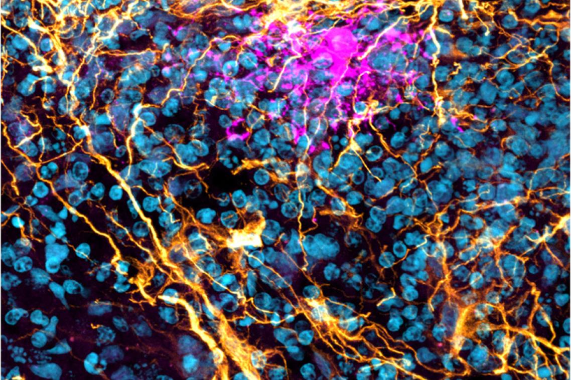 This section of a human brain organoid shows the star-shaped glial cells known as astrocytes, aged 140 days.