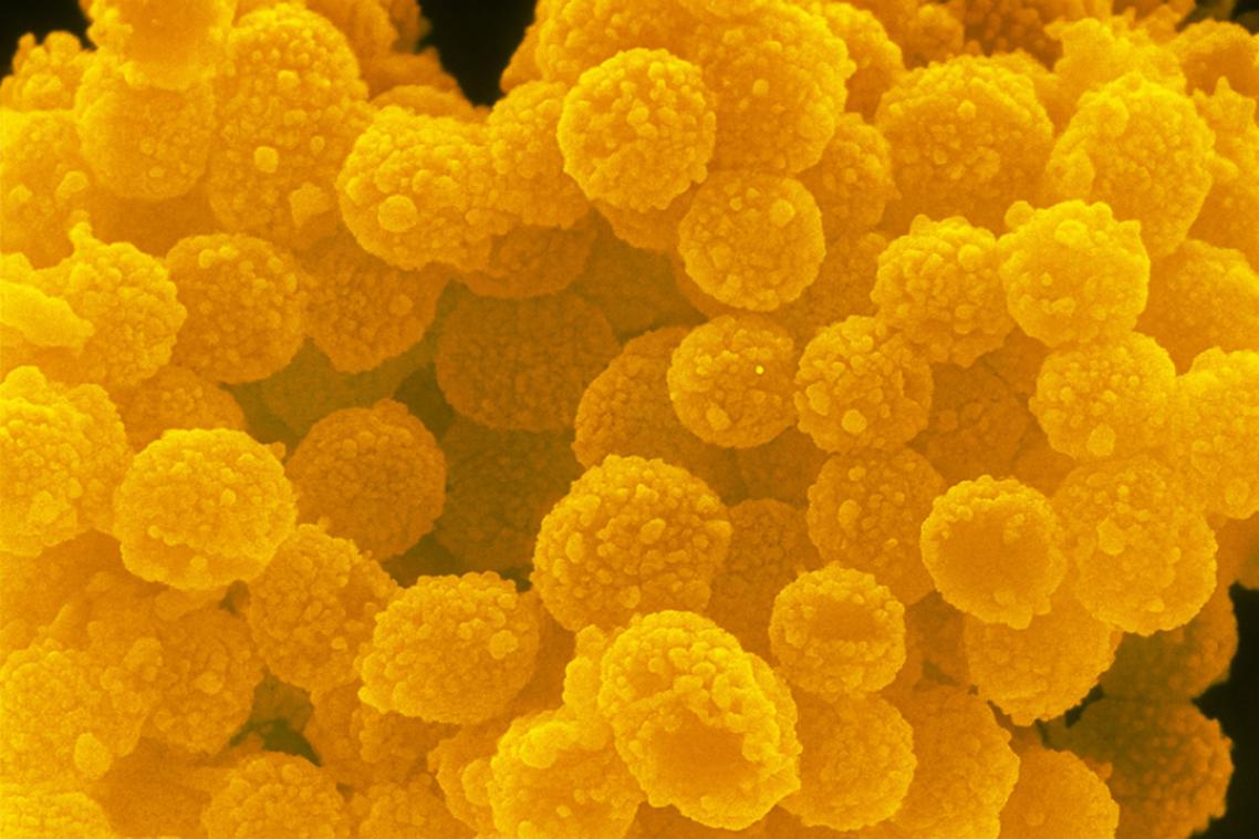 This striking image captured using a (SEM) actually showcases SiO ₂@ Au/Au nanostructure What looks delicious is, in fact, the intricate beauty of nanoscale engineering, where science meets art.