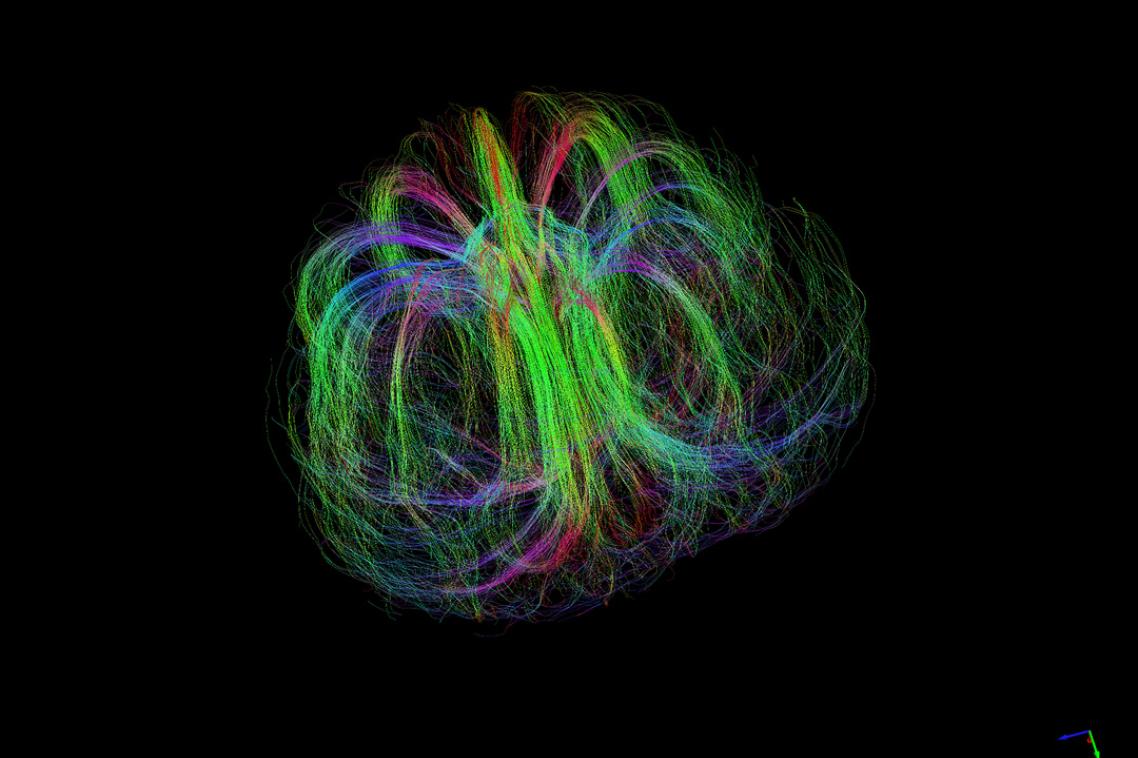 Here, diffusion MRI tractography has been to map a developing Burderkin plum, specifically the fibrous structures that supply various nutrients.