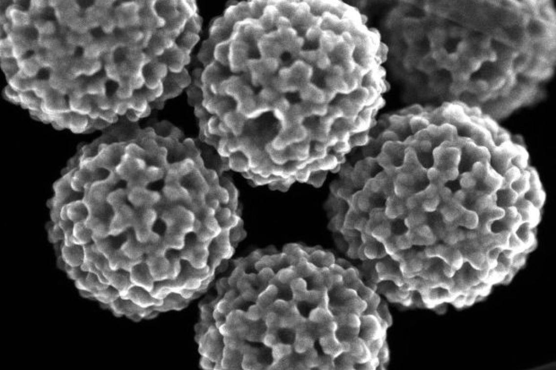 Mesoporous gold nanoparticles 