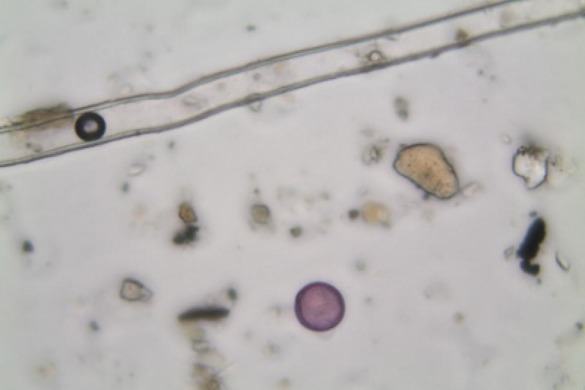 Image of a grass pollen, a major trigger of hay fever says UQ's Dr Janet Davies.