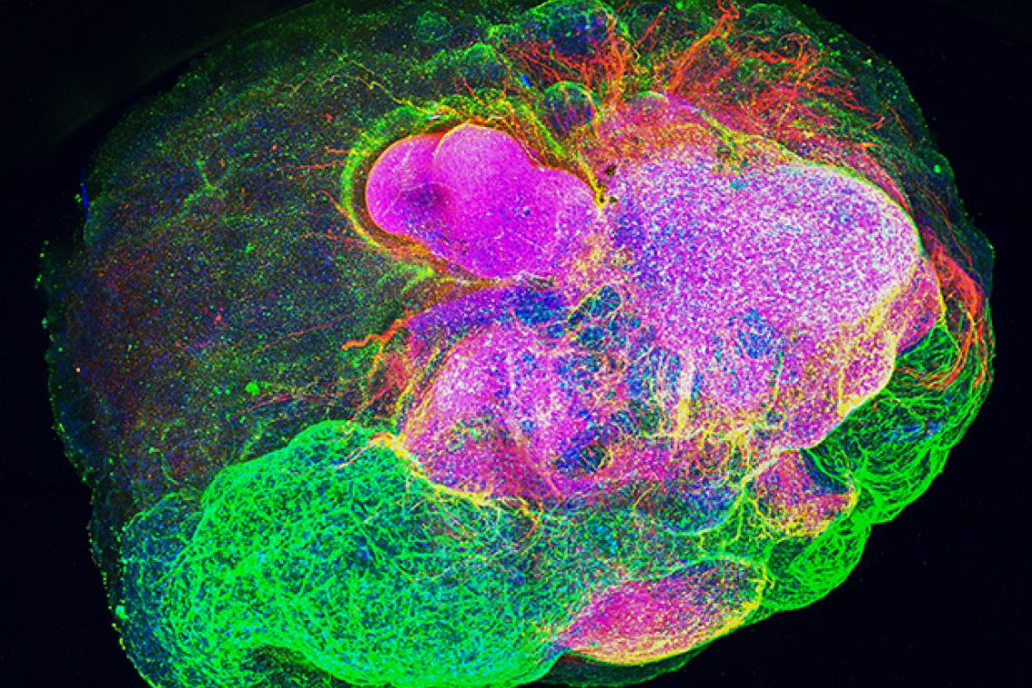 Green, pink. blue and yellow blobs and swirls on a black background