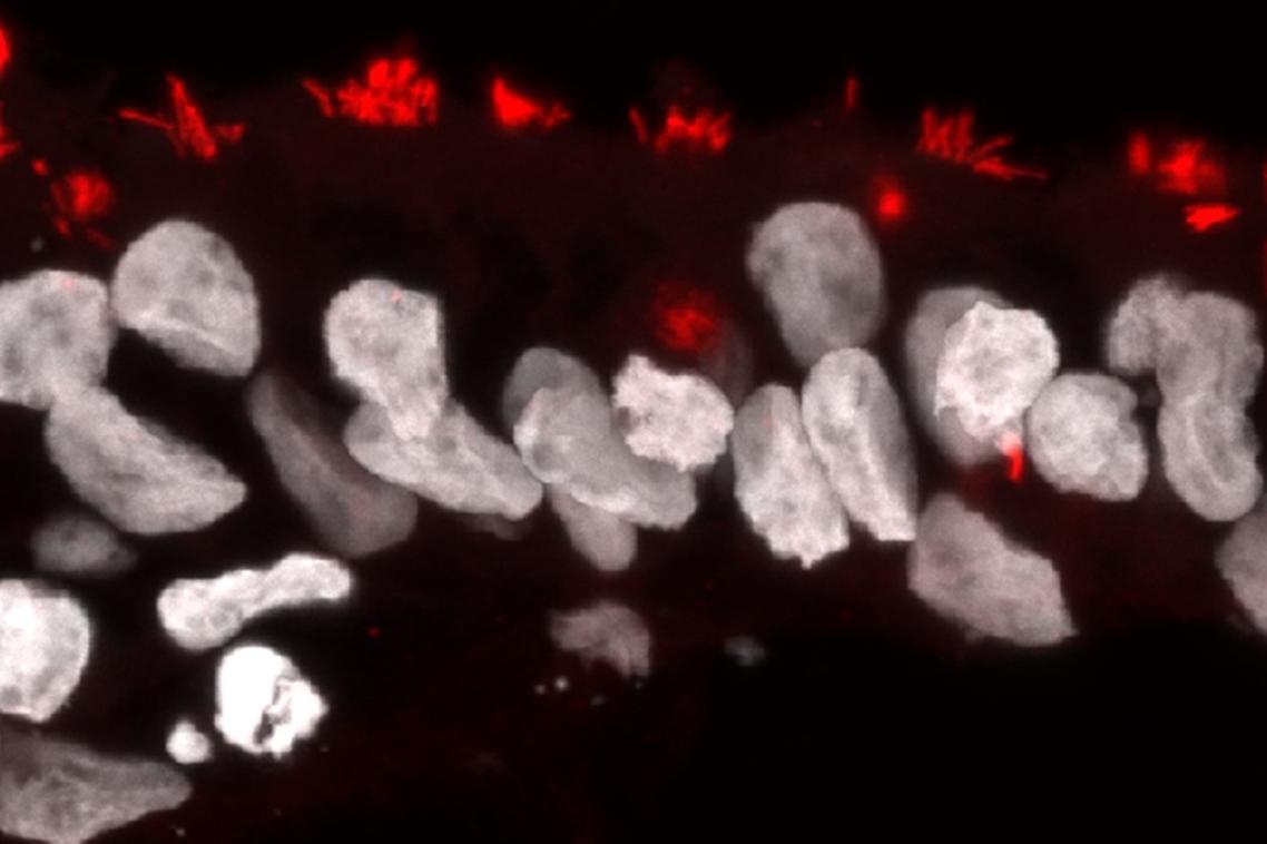 A microscopic view of brain organoids