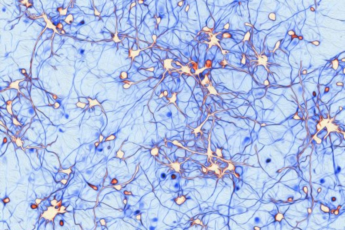 Dr Anggono’s winning entry shows neurons extending their axons to establish synaptic connections.