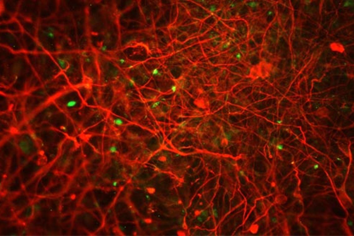 Red flourescence shows Alzheimer plaques in human stem cell derived neurons