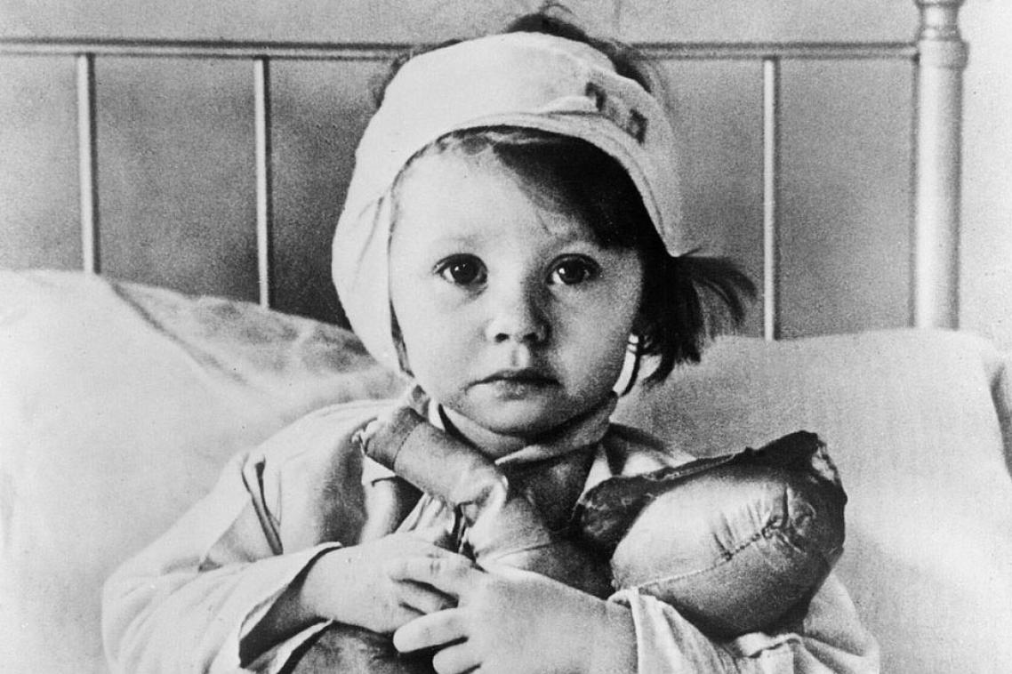 Head and brain injuries are infants' most frequent injuries from assault