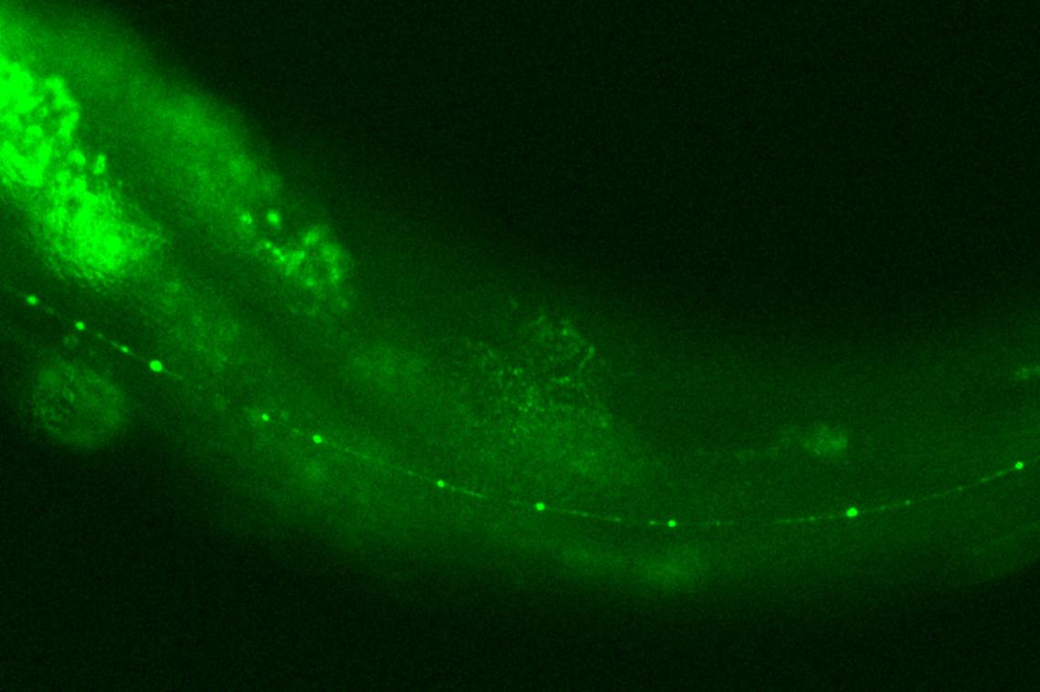 Caenorhabditis elegans (C. elegans)