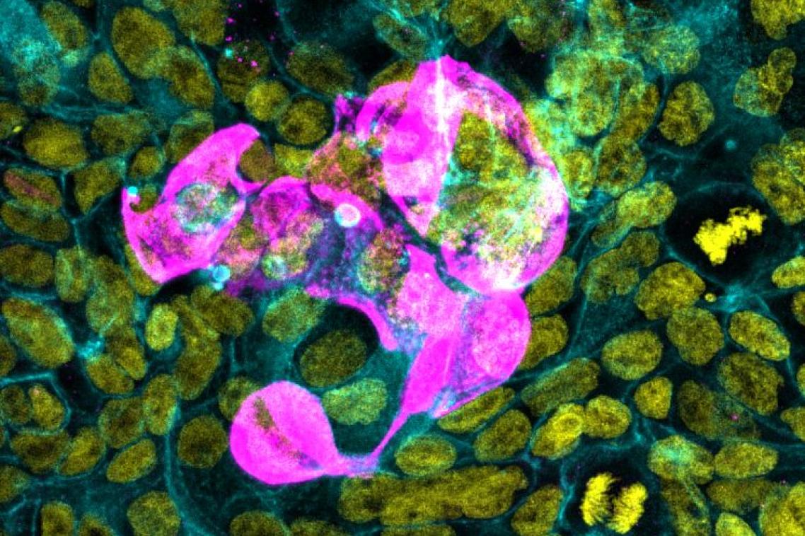 SARS-CoV-2 virus added to epithelial cells and infected cells shown in pink. 