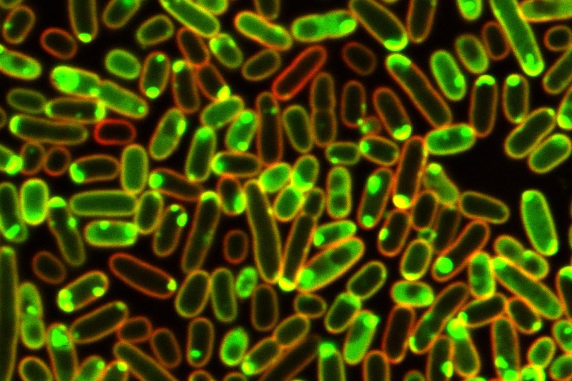 close up of green coloured bacteria