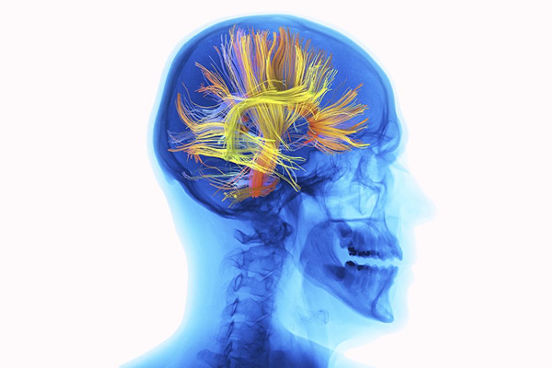 Brain scan