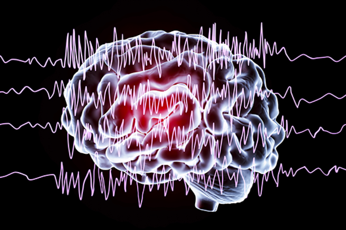 Image of a brain with simulated brainwaves