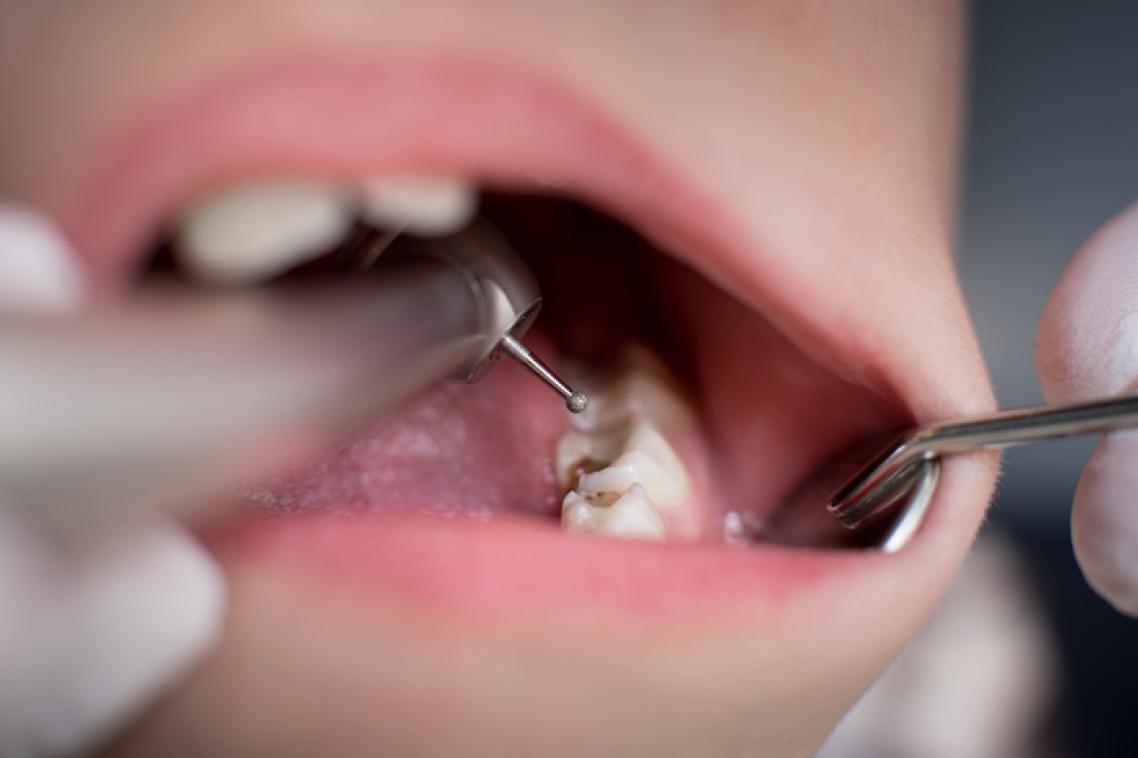 Open child's mouth with dental equipment visible inside