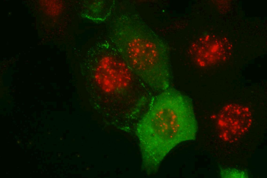 Red and green coloured image of proteins