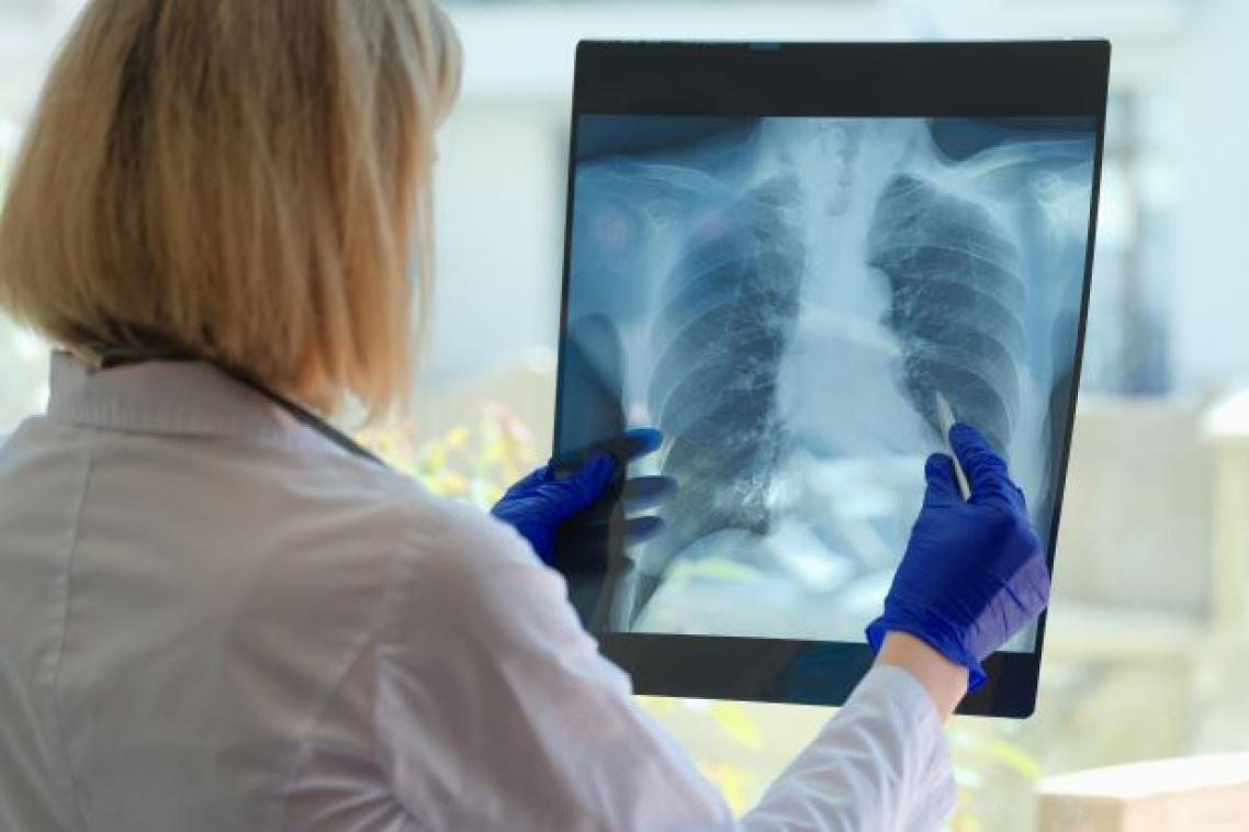 A person in a white coat looks at an xray of a rib cage and lungs.