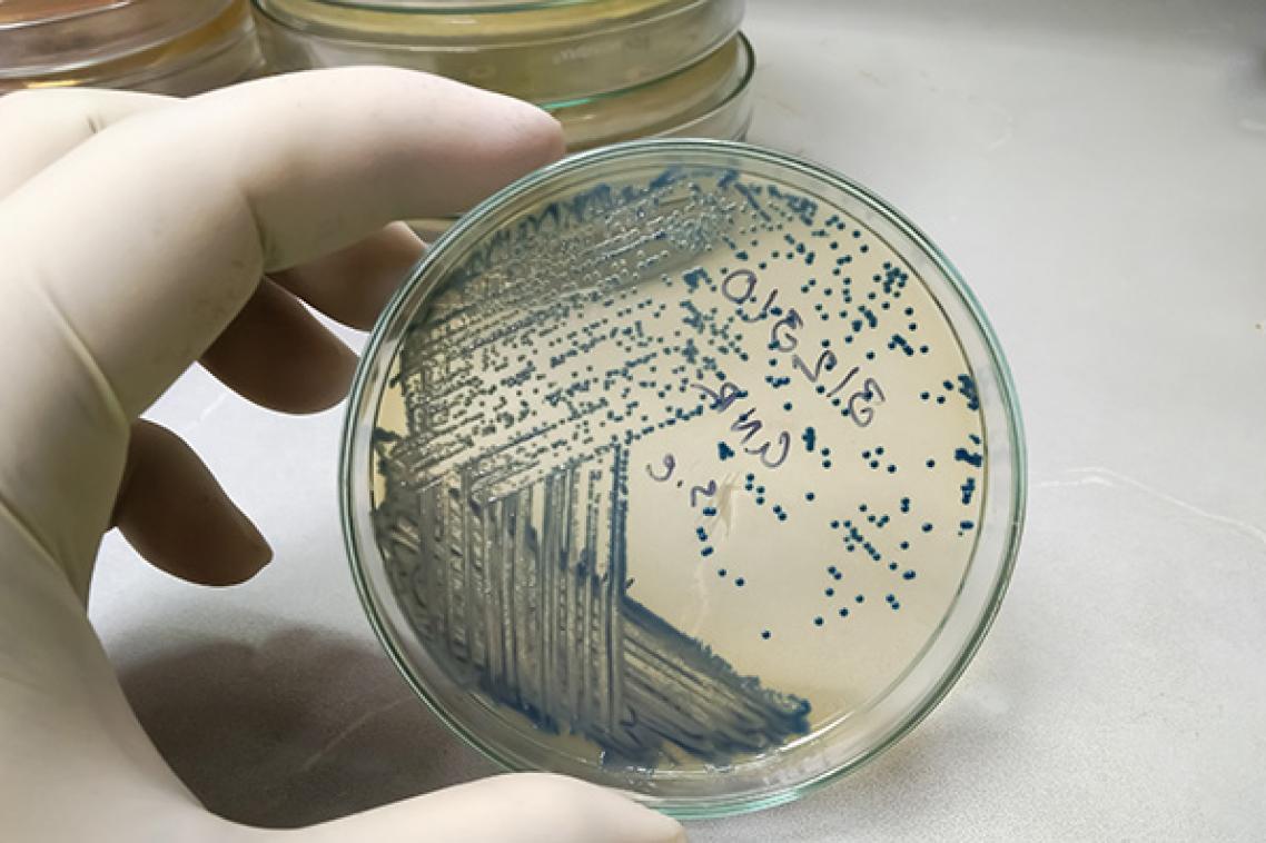 a gloved hand holds a clear dish which contains many blue dots