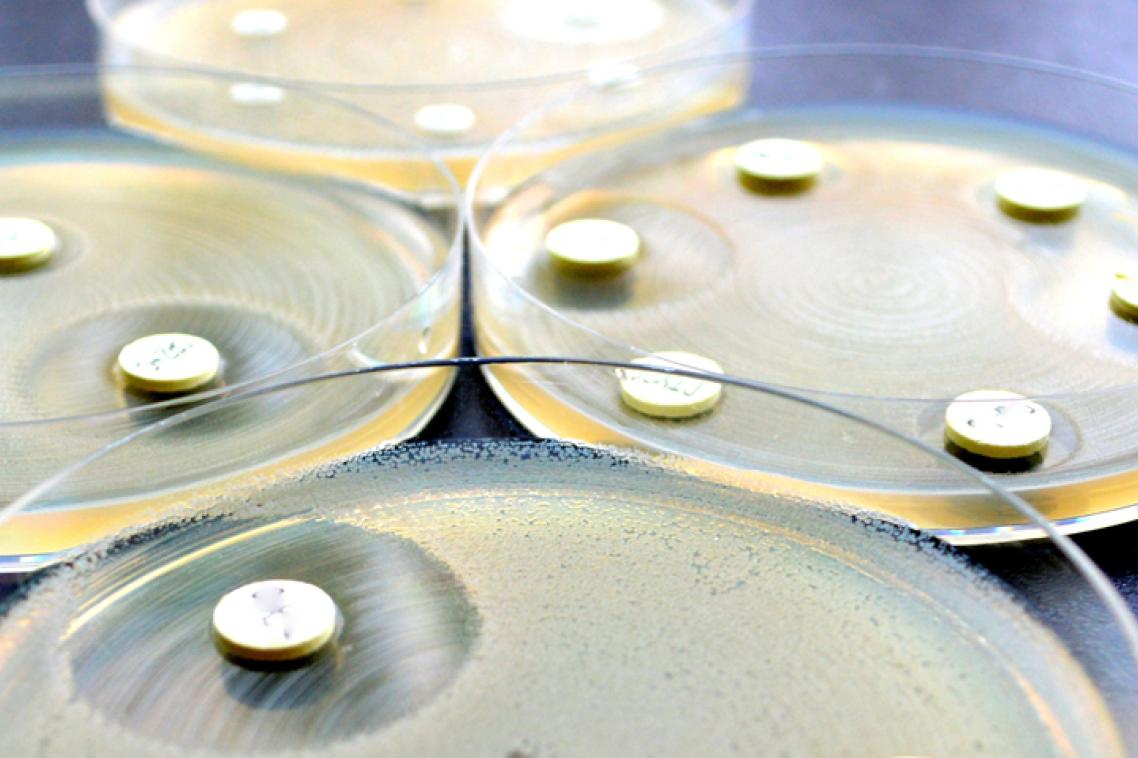 Antibiotic resistance is a global issue