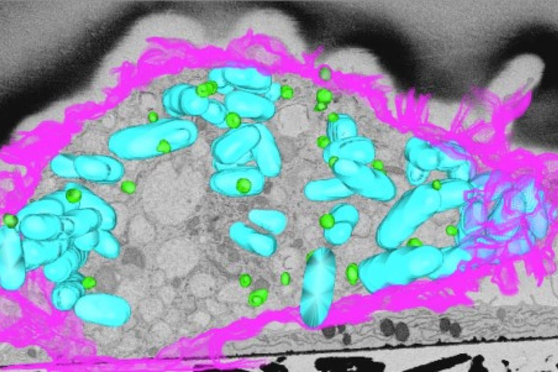 3D electron microscopy of macrophage infected by bacteria (blue) showing lipid droplets (green) and the cell surface (pink).