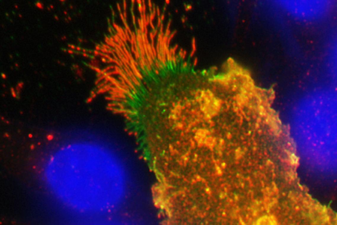 Uncontrolled inflammation can cause pain and drive disease