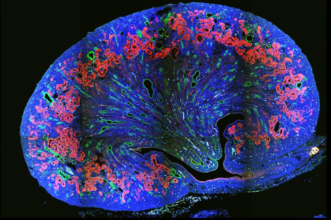 Cross section of a cystic kidney - Maria Rondon Galeano, UQ IMB