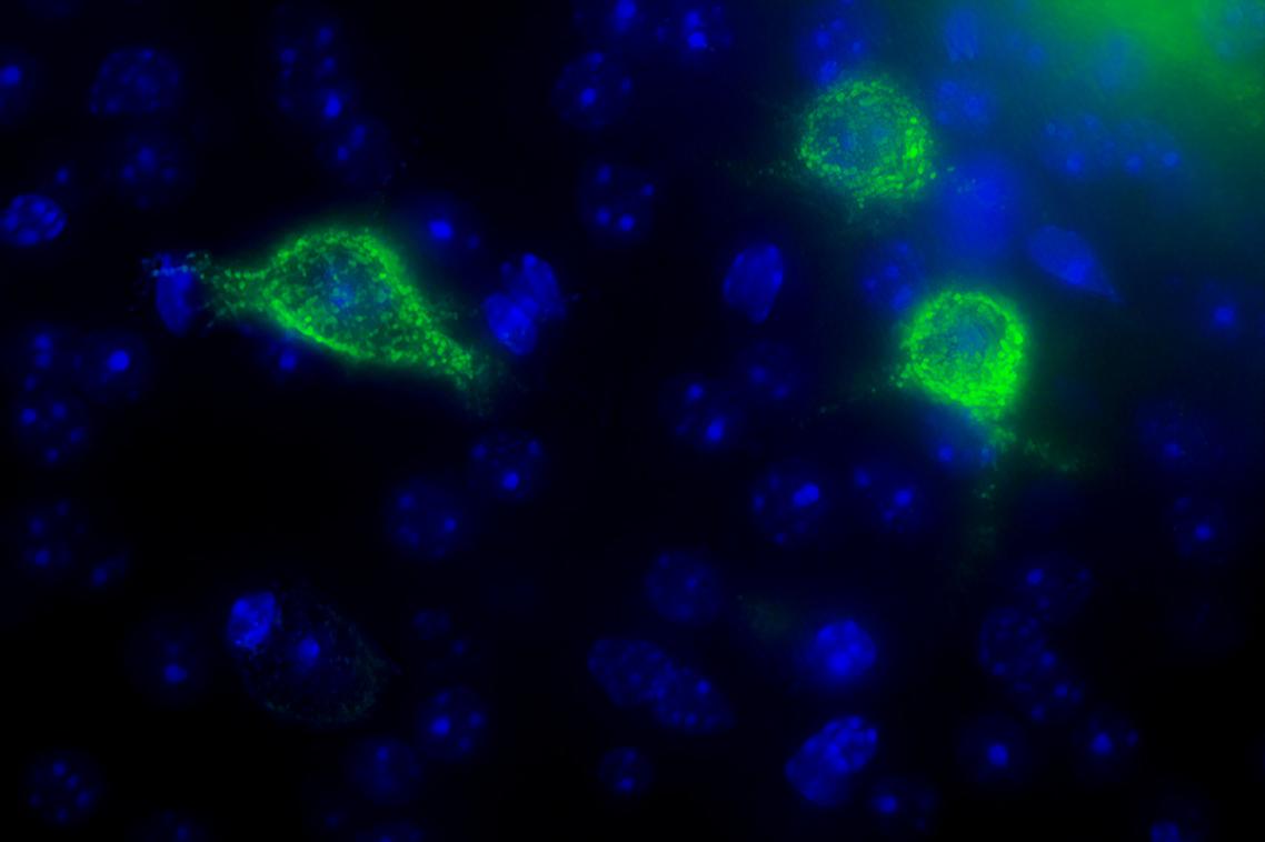 Perineuronal nets (bright green) surround particular neurons (blue). Fluorescence labelling reveals just how detailed these structures are. (Phoebe Mayne, UQ)