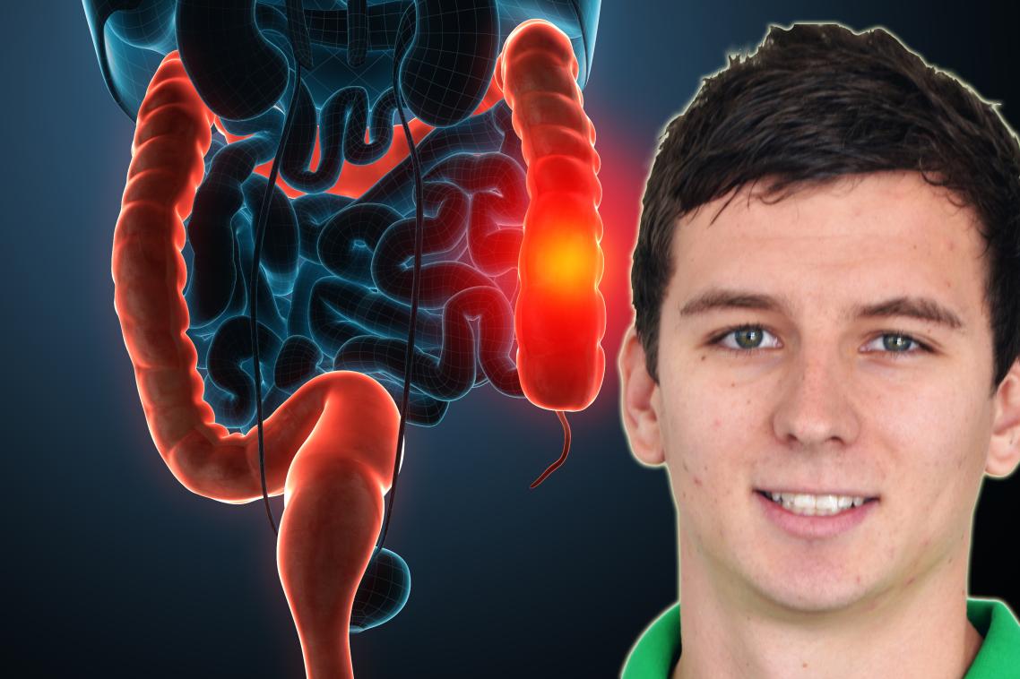 James Devin has studied the effects of exercise on colorectal cancer survivors.