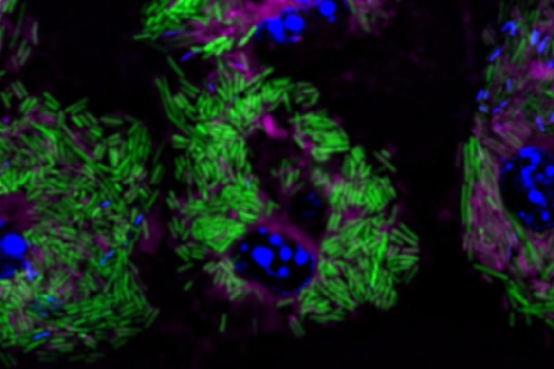 Image of listeria in blue and green colours
