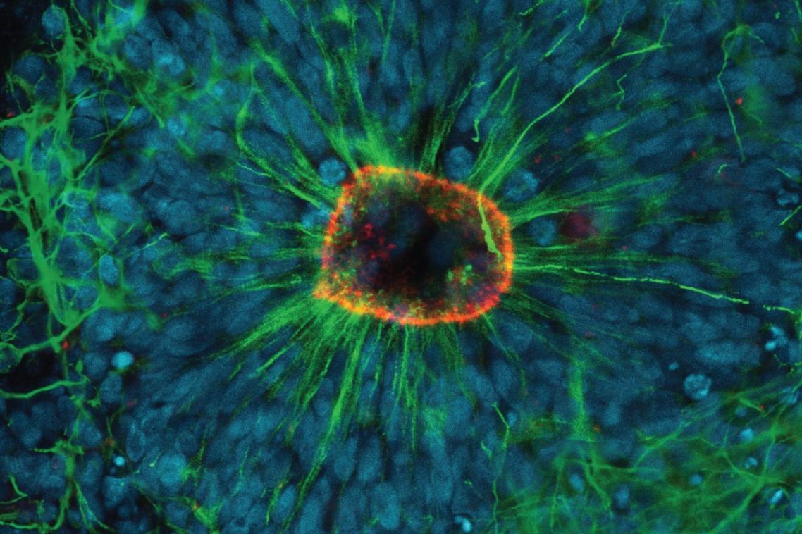 Red: Tight junction marker (Zo-1) demonstrating the apical surface. Green: Cytoskeleton marker (TUBB-3) showing the radial structure of the rosettes. Blue: Nucleus of cells (DAPI).