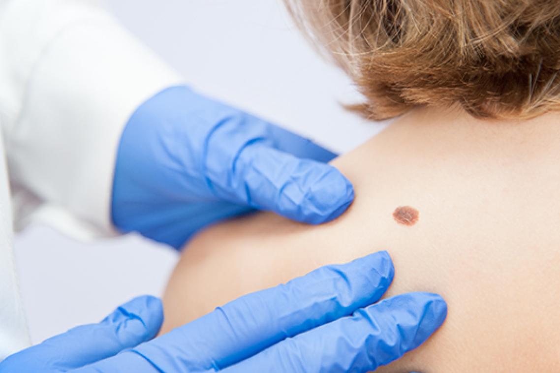Stock image of a doctor examining a patient's skin