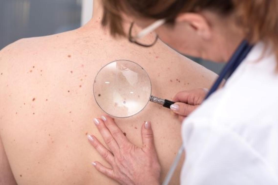 A person in a white coat and goggles is using a magnifying glass to examine spots on a person's back.
