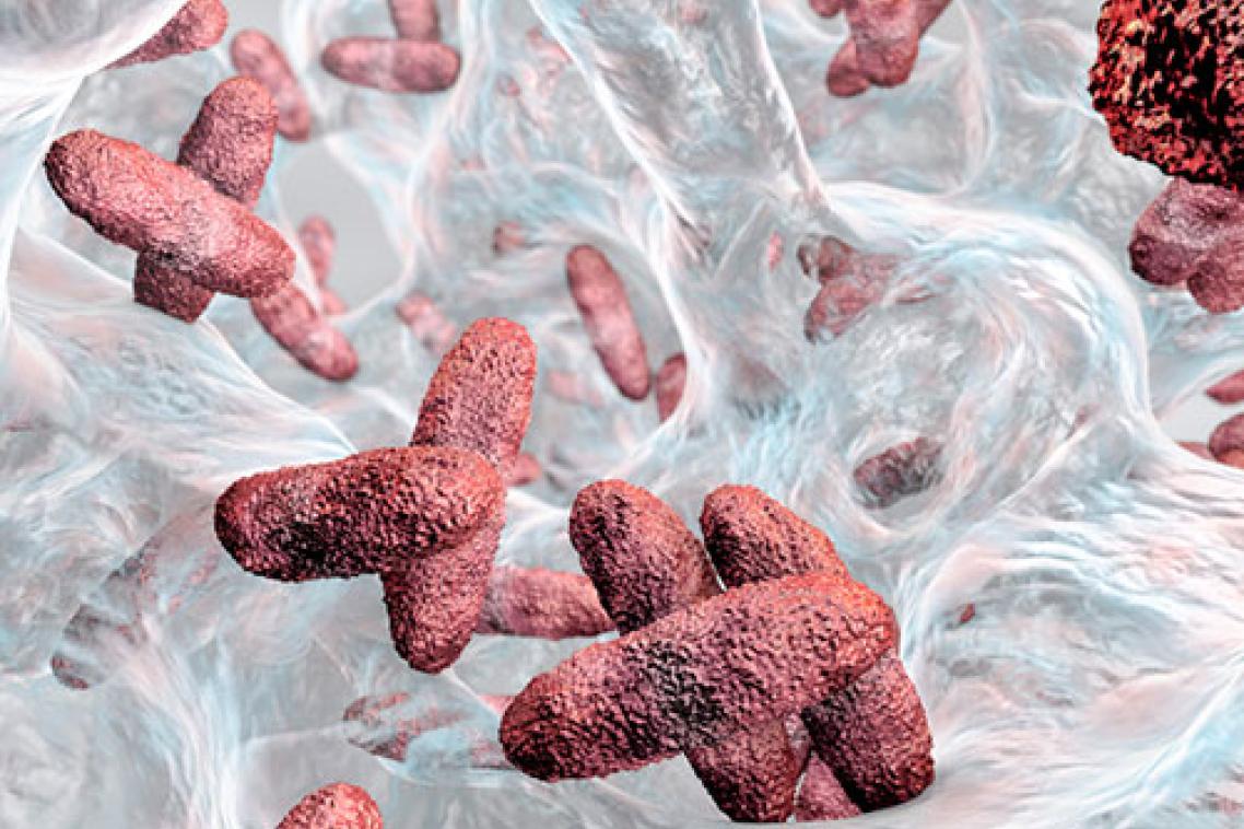 Superbug Klebsiella