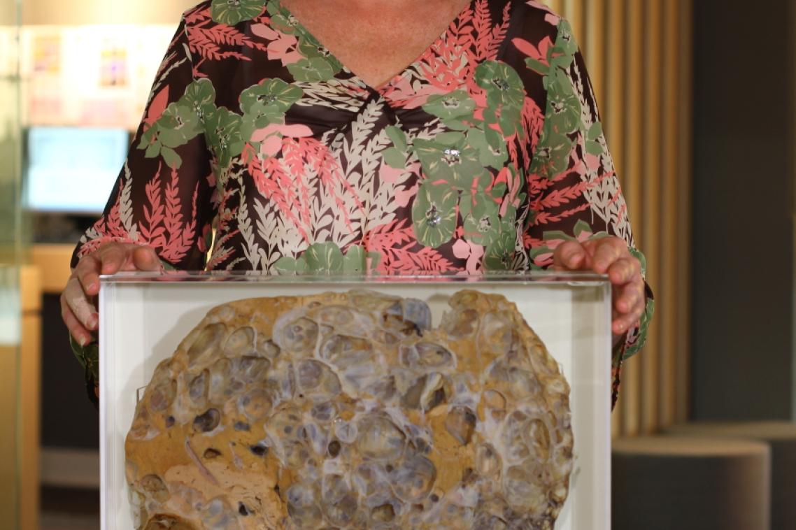  Fiona Murray, a kidney and liver recipient, donated her polycystic liver to UQ