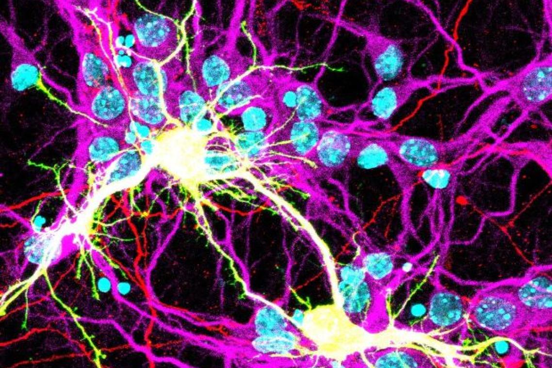 A brightly coloured network of intersecting lines against a black background, some fusing where they meet.
