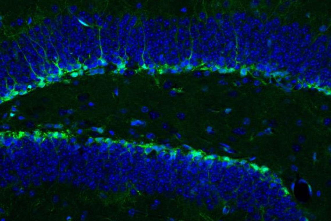 An image taken from a microscope with two thick bright green & blue lines on a black background.