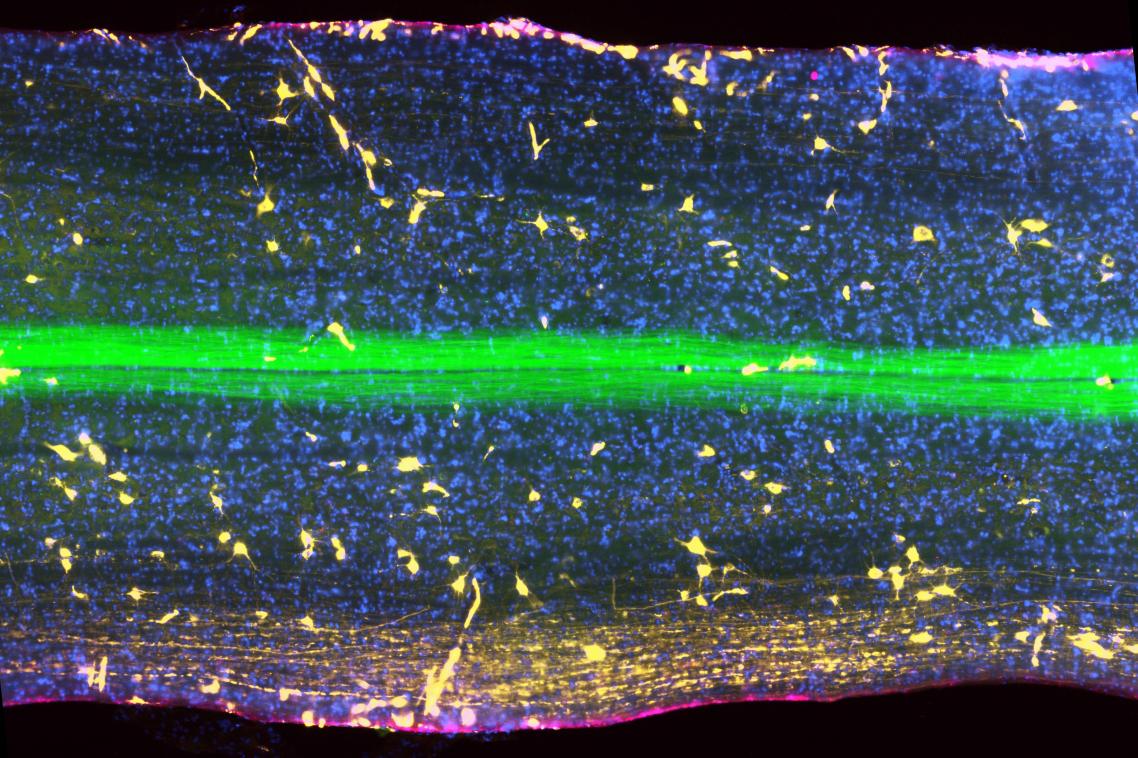 A slice through a spinal column showing the physical connection that links the brain to muscles.
