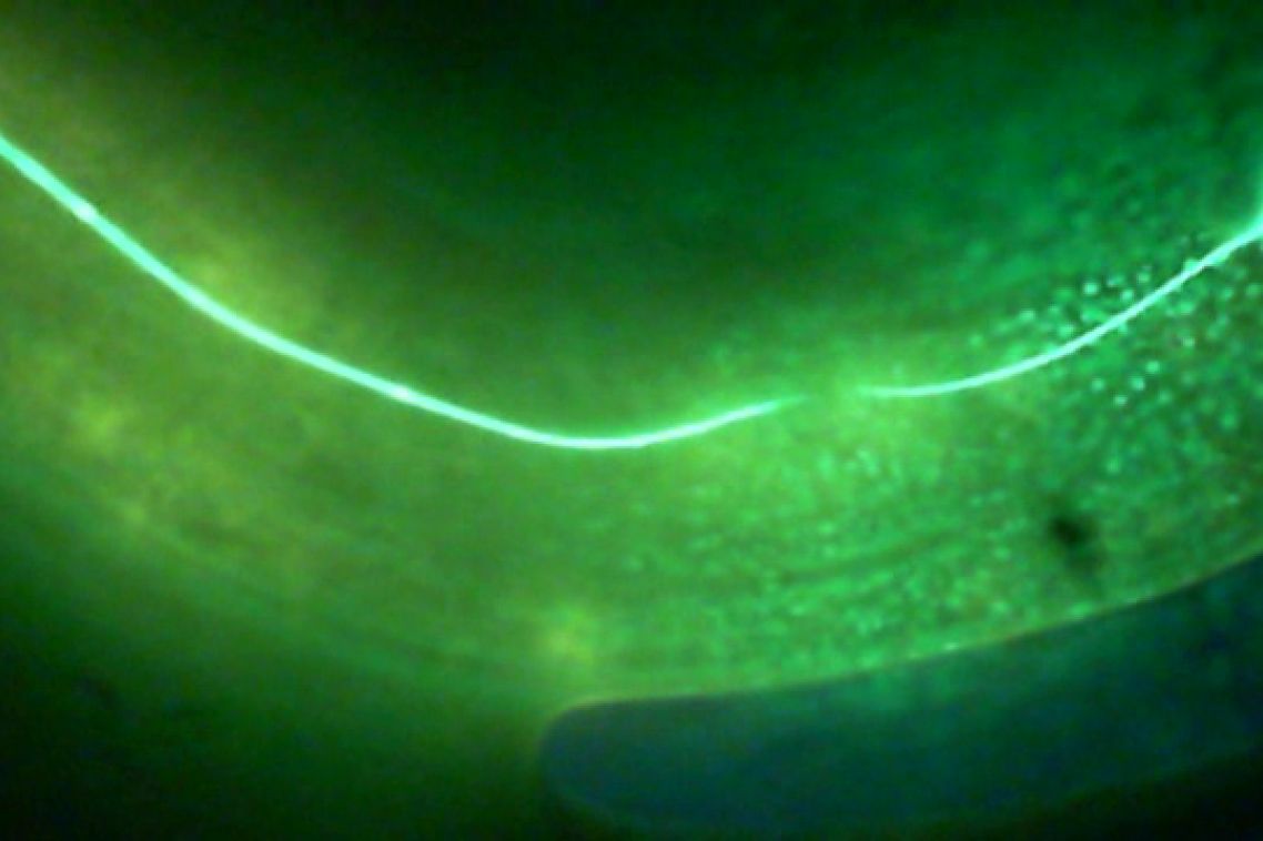 A severed nerve cell - microscopic roundworm species C. elegans can mend severed nerve cells through a process called axonal fusion.