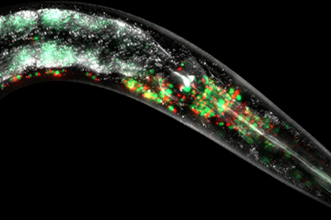 Mitochondria labelled by fluorescent red, and green proteins in the neurons.