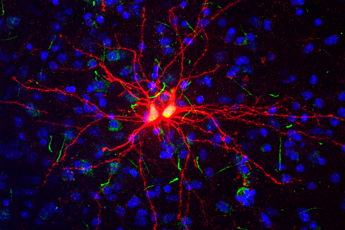 Newly generated twin neurons in the adult amygdala, an area of the brain playing a central role in emotional processing.