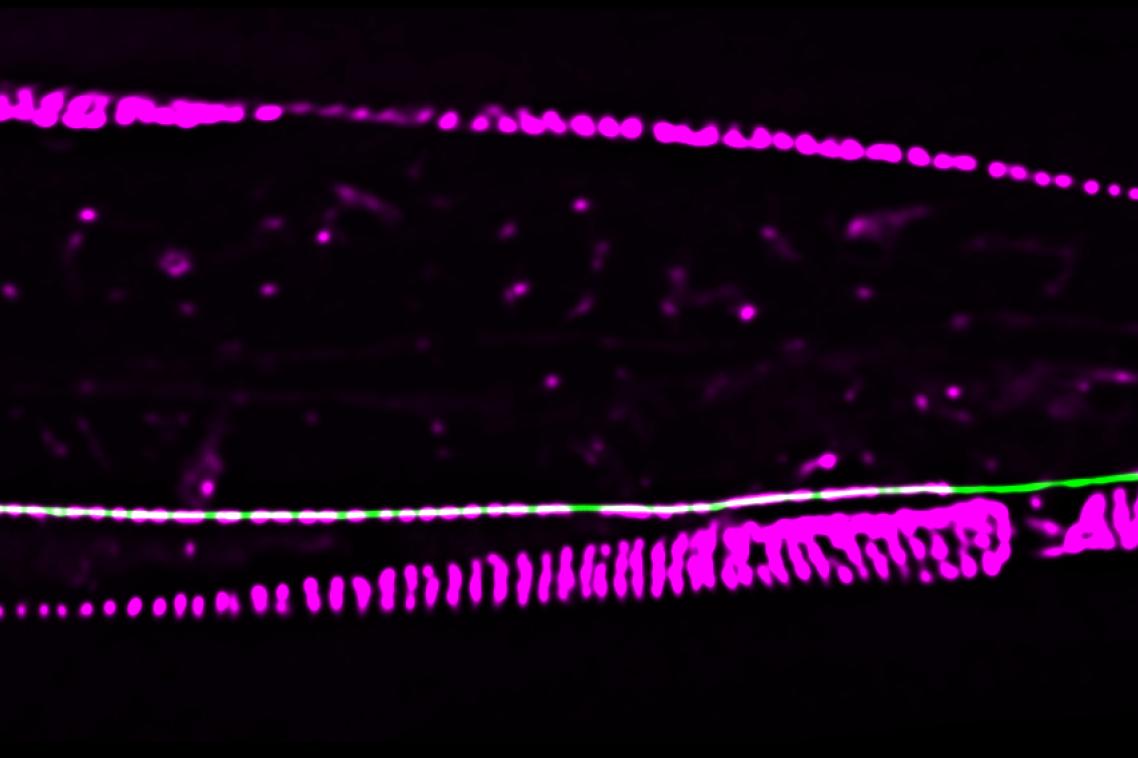 Attachment sites (magenta) in the surrounding skin of roundworm nerve cells act as a glue, helping the cells remain intact during periods of strain.