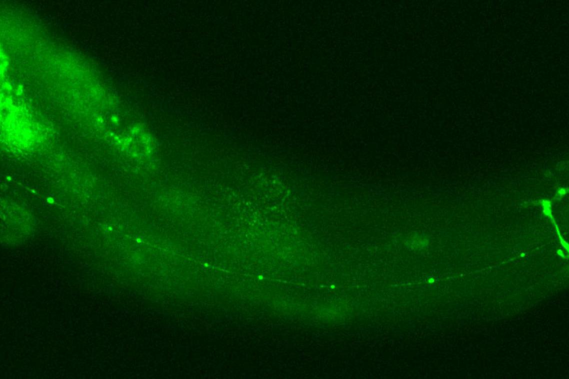 The worm is less than 1mm long, and has the same proteins as in flies, mice and humans.