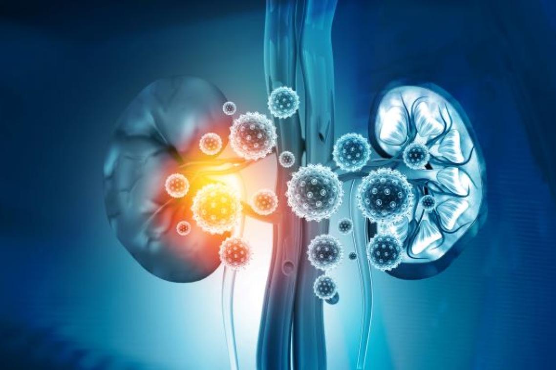 A graphic of human kidneys, with one inflamed.