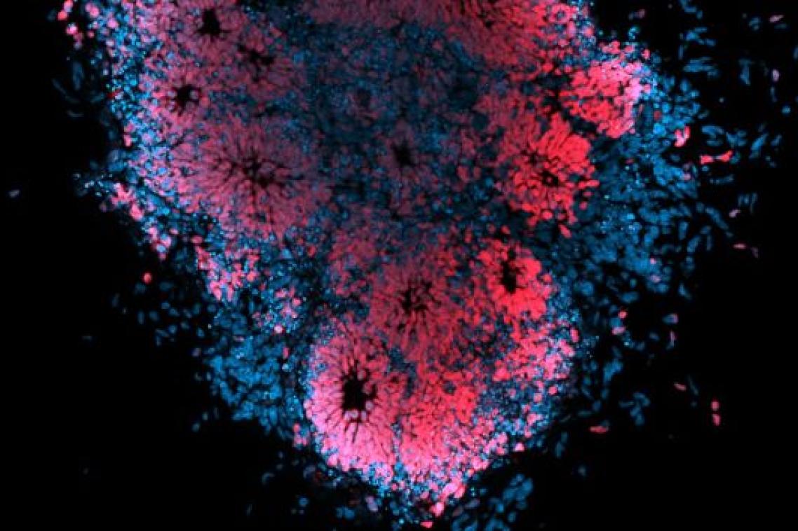 clusters of pink dots surrounded by blue dots on a black background