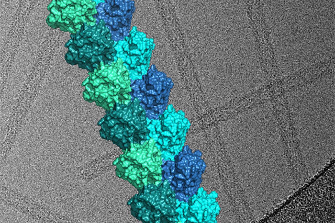 Image: Cryo-electron microscopy-derived three-dimensional structure of a filament formed by the Toll-like receptor adaptor protein MAL, shown above a representative electron micrograph used to derive this structure. Credit: Thomas Ve.